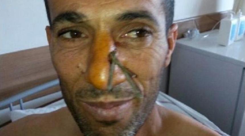 İnşaatta D&uuml;şen Iş&ccedil;inin Burnuna Tel Battı