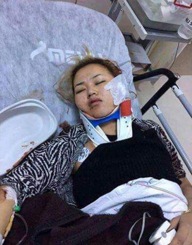 Fuhşa Zorlanıp Öldüresiye Dövülen Kırgız Kadın Için Yardım Çağrısı