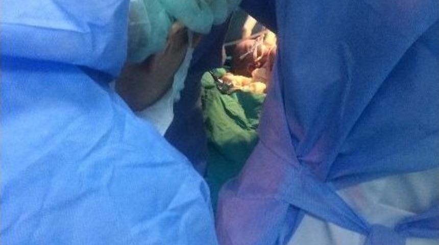 Diyarbakırlı Ailenin Siyam İkizleri Ankara&rsquo;da D&uuml;nyaya Geldi