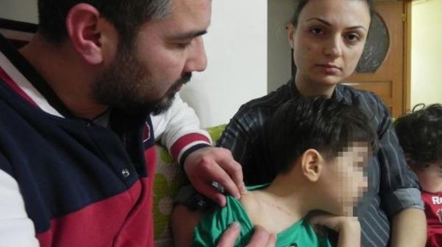 Anaokulundaki &Ccedil;ocuğun Boynundaki &Ccedil;iziklere Karşılıklı Su&ccedil;lama