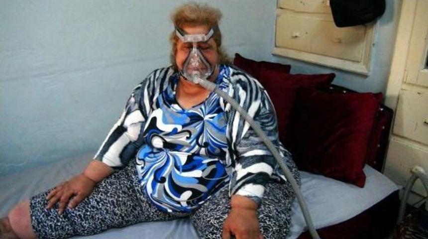 185 Kiloluk Kadın Tedavi Olmak Istiyor