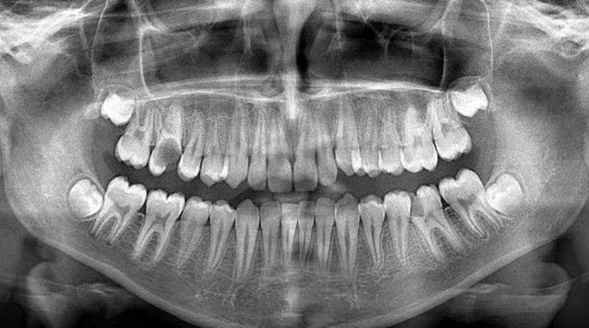 Yenişehir&rsquo;de Yeni Ağız Ve Diş Sağlığı Merkezi Yapılıyor