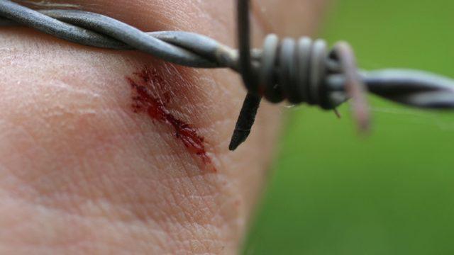 Tetanoz Aşısı 10 Yılda Bir Yapılmalı!