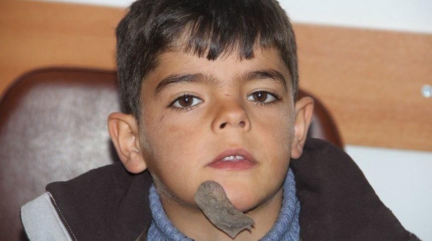 &Ccedil;enesinde T&uuml;m&ouml;r Olan &Ccedil;ocuğa Kaymakam Sahip &Ccedil;ıktı