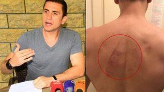 Ünlü futbolcu Emre Aşık darp fotoğraflarını paylaştı