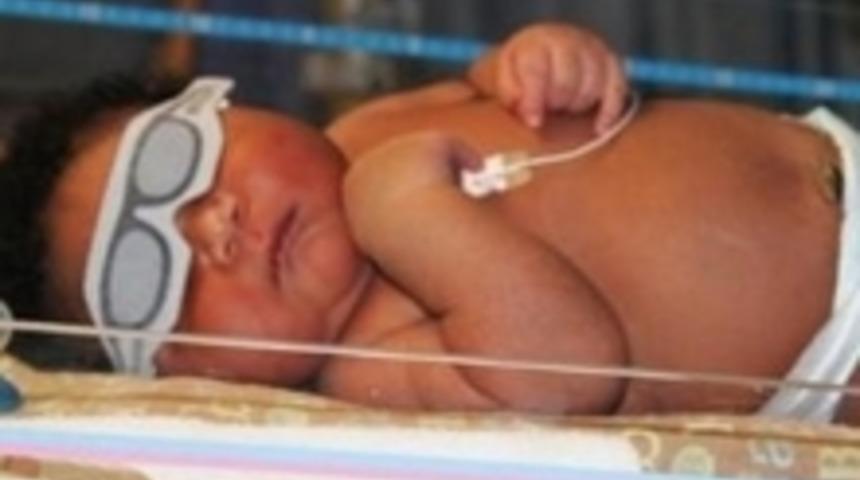 7 Kilo doğdu!