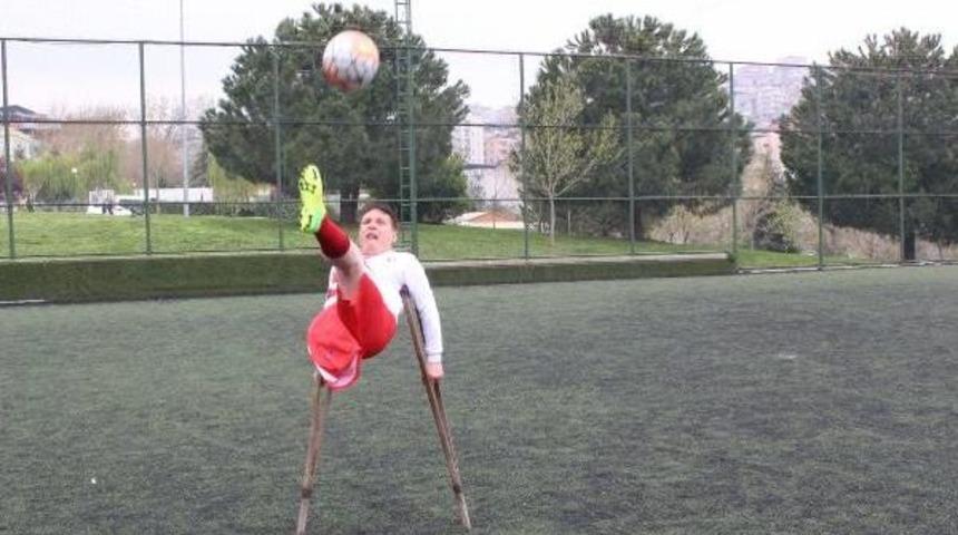 7 Yaşında Sağ Bacağını Kaybetti, Futbolla Zirveye Ulaştı