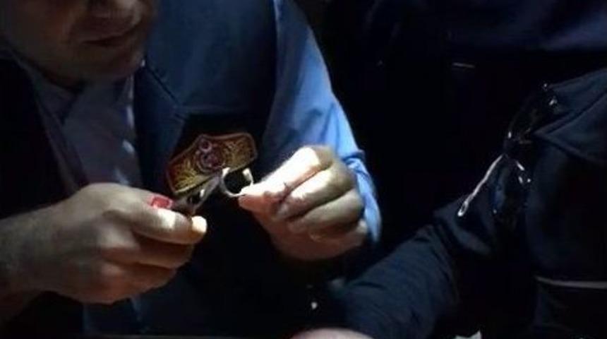 Kavgada Parmağı Kırılan Polisin Y&uuml;z&uuml;ğ&uuml; İtfaiye Tarafından &Ccedil;ıkartıldı