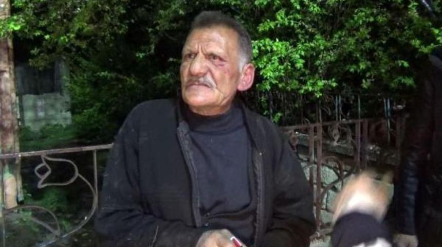 Gece &Ouml;nce Bacağından Vuruldu, Sonra Evi Yakıldı