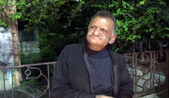 Silahla Ayağından Vurdukları Şahsın Evini Yaktılar 2