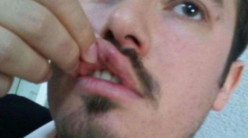 Fet&ouml; Davasında Tanık, Sanık Avukatına Kafa Attı