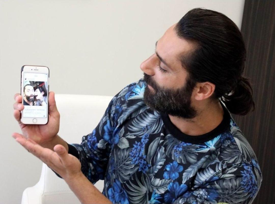 Survivor&rsquo;dan Sonraki İlk İşi Burnunu D&uuml;zeltmek Oldu