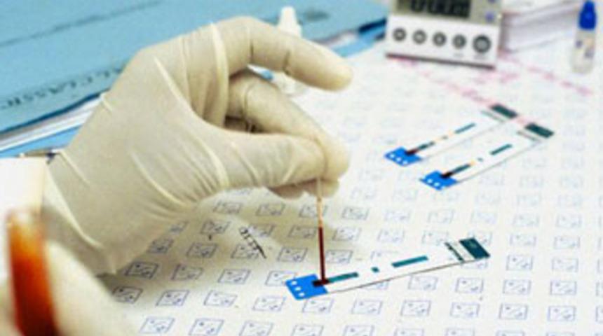 Yeni bir 'AIDS' hastalığı ortaya &ccedil;ıkabilir