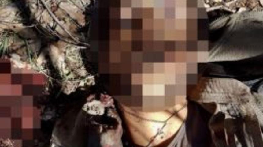 Etkisiz Hale Getirilen Ter&ouml;ristin Boynundan Ha&ccedil; &Ccedil;ıktı