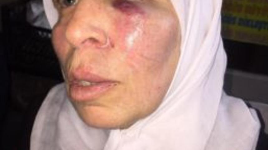 İzmir&rsquo;de Yaşlı Kadın Acımasızca Yumruklandı