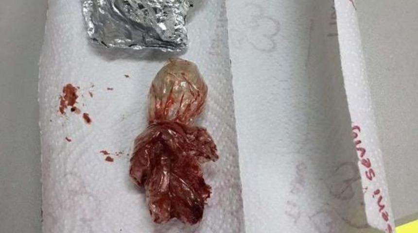 Eroini Cinsel Organına Saklamış