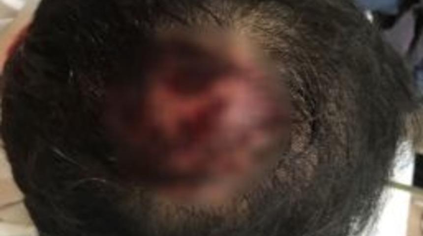 İzmirli İşadamı &Ouml;ld&uuml;resiye D&ouml;v&uuml;ld&uuml;