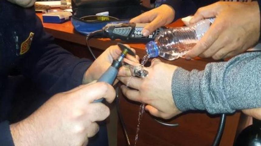 Parmağa Sıkışan Y&uuml;z&uuml;k Kesilerek &Ccedil;ıkarıldı