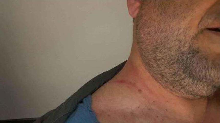 U&ccedil;ak'ta Başlayan Tartışmanın Ardından Apronda D&ouml;v&uuml;ld&uuml;