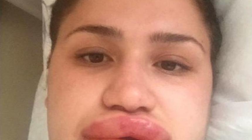 Sahte Estetik&ccedil;inin Tahliyesine Itiraz Rededildi