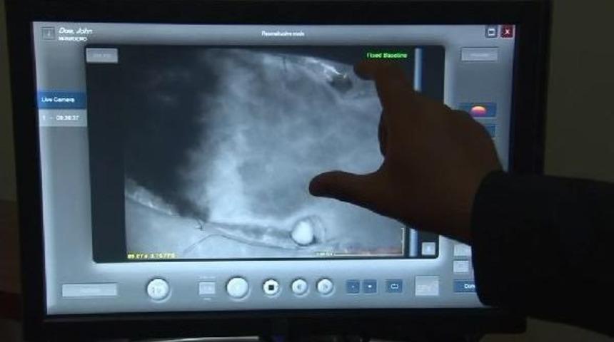 Bağcılar'da Ameliyat Sonucuna Işık Tutacak Sistem