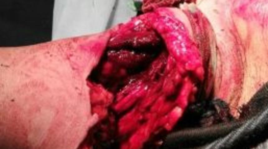 G&uuml;bre Dağıtım Makinasını Deneyen Polis Kolonu Makinaya Kaptırdı