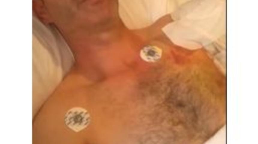 İş Makinesine Kaptırdığı Kolu Yerine Dikilemedi, Yine De Ş&uuml;kretti