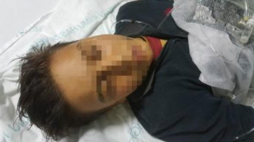 12 Yaşındaki &Ccedil;ocuğu Arkadaşı Kazara Vurmuş