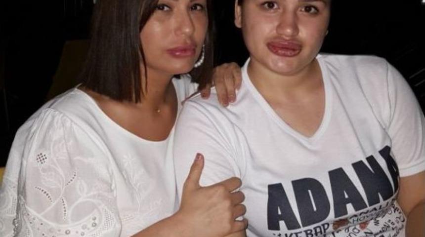 Estetik Mağdurları Buluştu