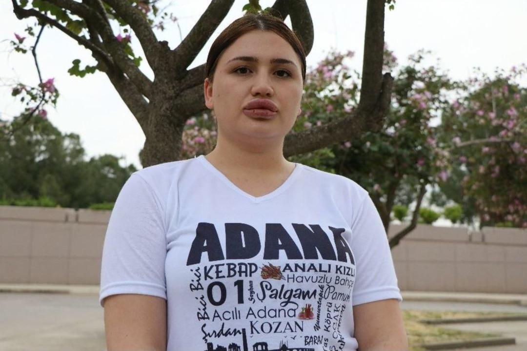 Sahte Estetik&ccedil;i Tutuklandı, Merve Hemşire Sevindi