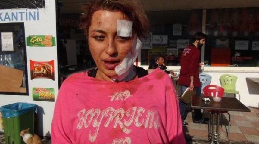 &Ccedil;orum'da Otob&uuml;s Devrildi: 1 &Ouml;l&uuml;, 38 Yaralı (2)