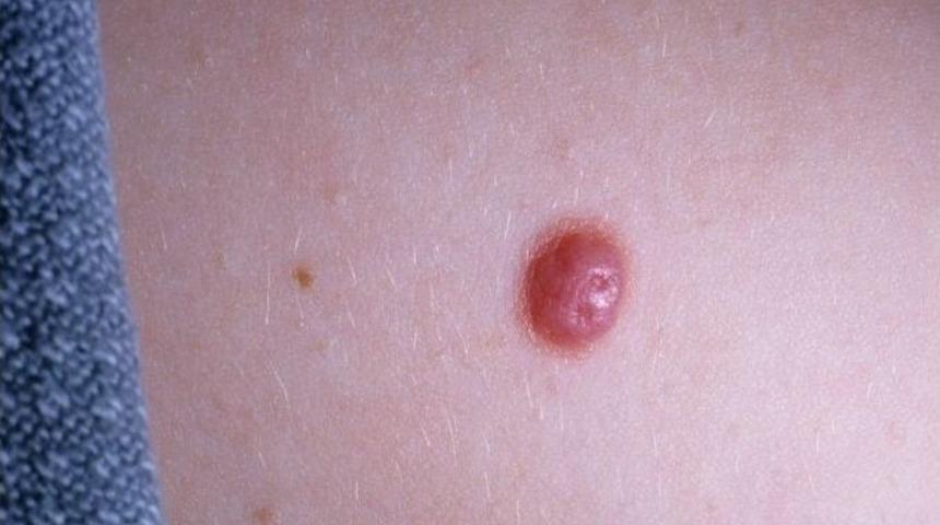 Benlerdeki Bu Değişimlere Dikkat