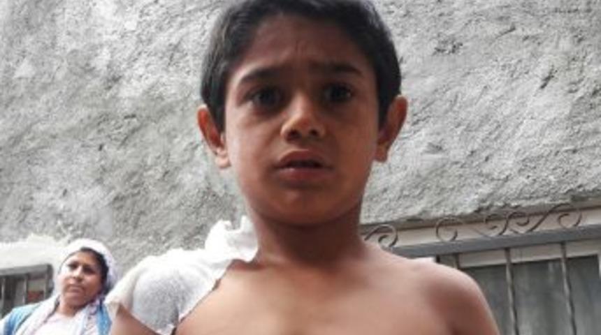 Sıcak Suyla Saldırılan Minik Çocuk Konuştu