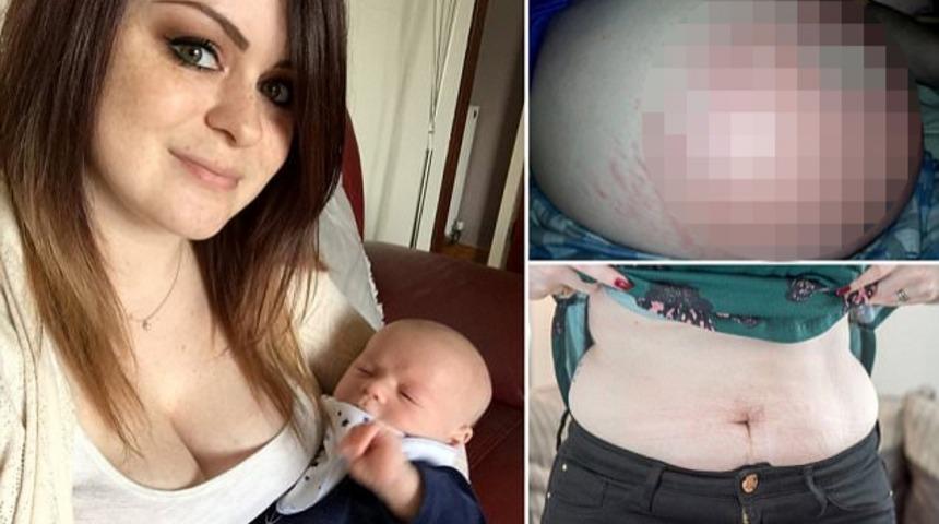 Hamileyken hamileliğe alerjisi olduğunu &ouml;ğrendi