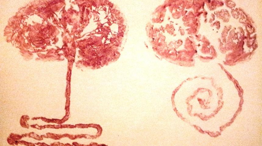 Plasenta Print Art Nedir?