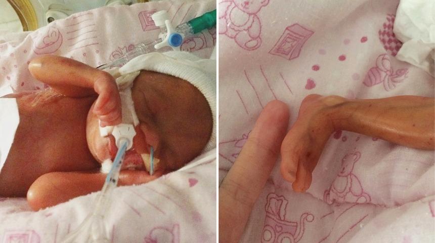 'K&uuml;&ccedil;&uuml;k bir mucize' Doktorlar t&uuml;m &uuml;mitlerini kesmişti