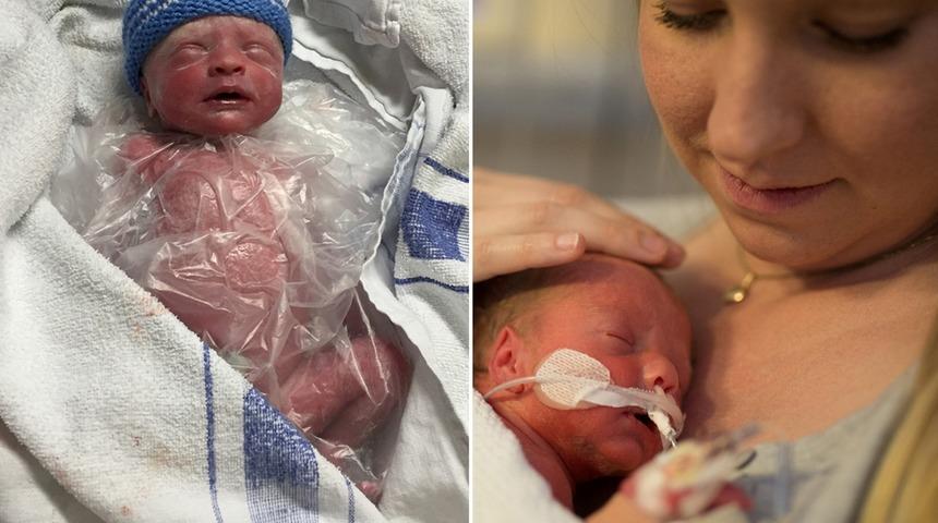 Premat&uuml;re bebek sandvi&ccedil; torbasında hayata tutundu