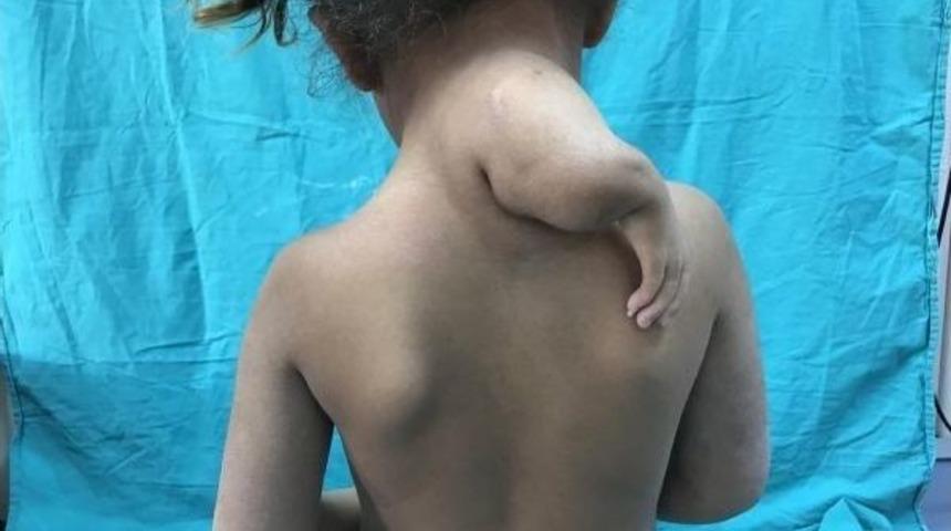 3. Kolu Boynunda D&uuml;nyaya Geldi