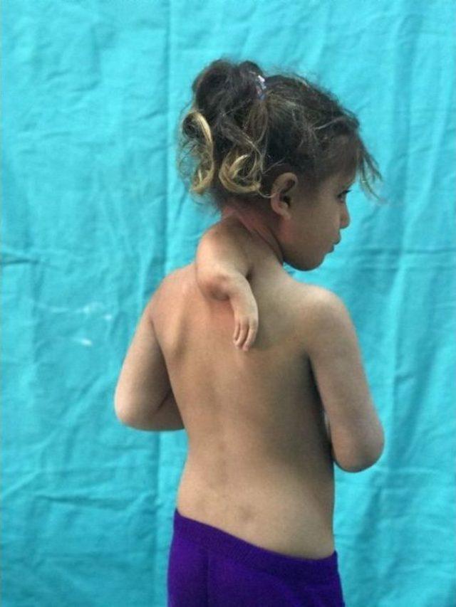 3. Kolu Boynunda D&uuml;nyaya Geldi 1