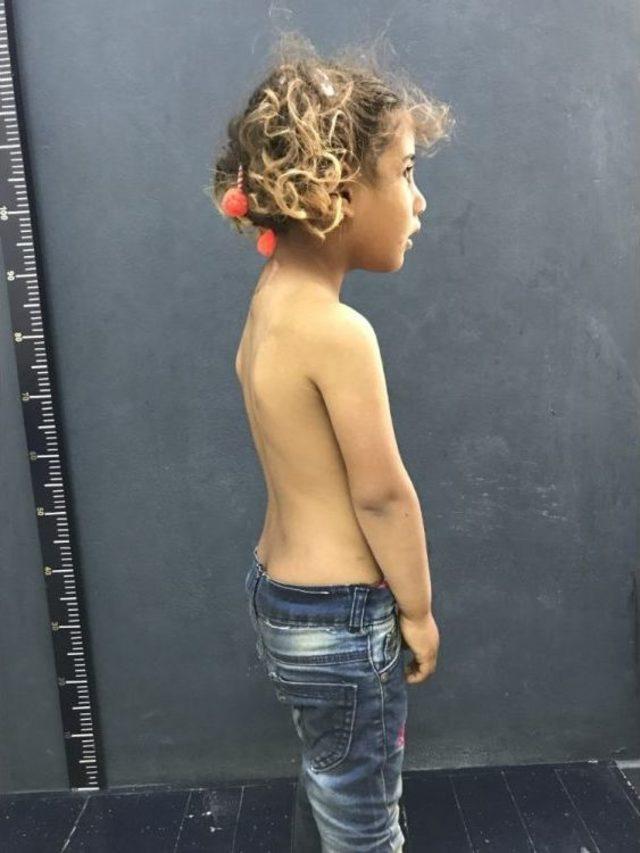 3. Kolu Boynunda D&uuml;nyaya Geldi 2