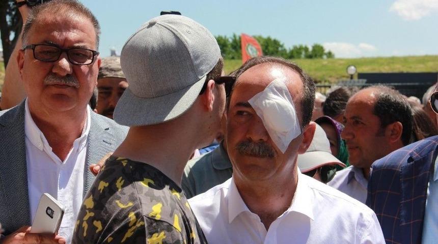 Başkana Yumurta İle Saldıran Şahıs Tutuklandı