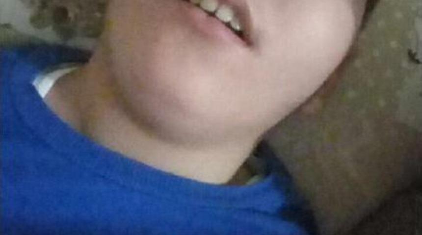 Fenalaşan Zihinsel Engelli &Ccedil;ocuk Hayatını Kaybetti