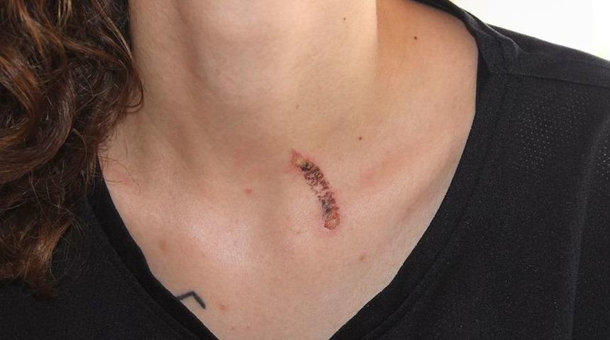 Sokakta Gen&ccedil; Kıza Sigaralı Saldırı