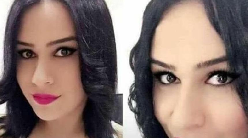 Cinsiyet Değişimi Ameliyatı Sonrasında Hayatını Kaybetti