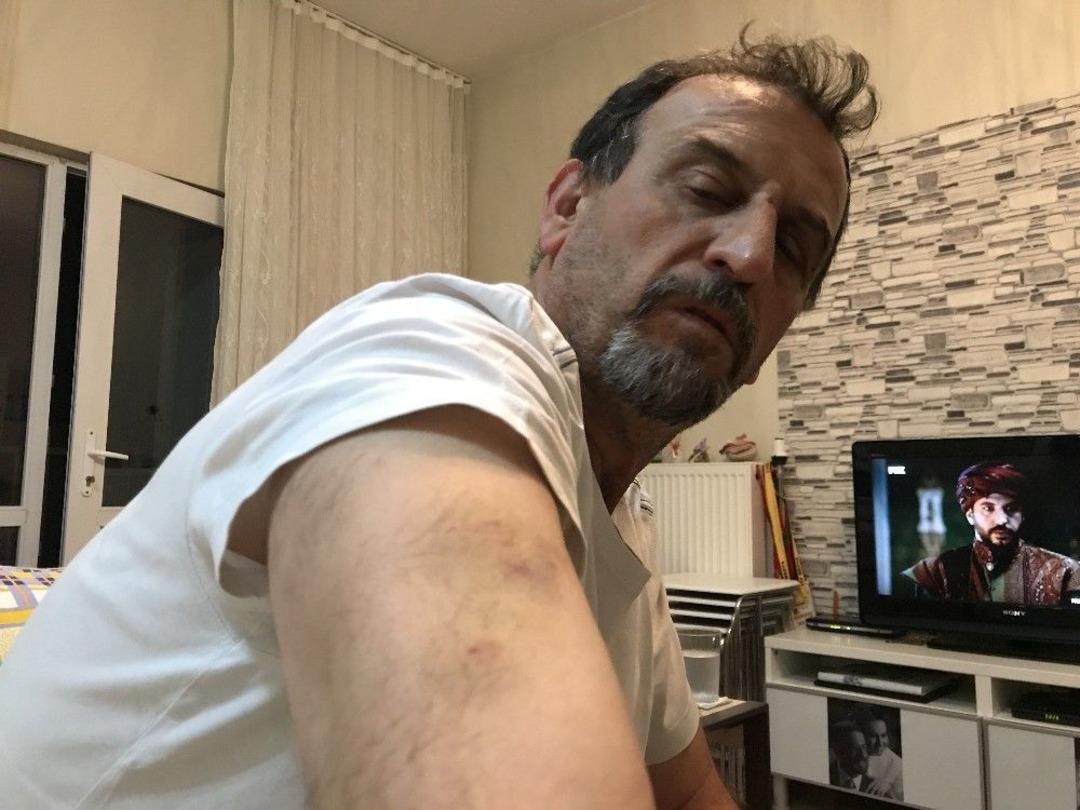 "engelli Yoluna Park Etme" Dediği İ&ccedil;in Lin&ccedil; Edildi..