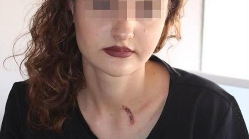 Gen&ccedil; Kızın Boynunda Sigara S&ouml;nd&uuml;ren Ş&uuml;pheli Tutuklandı