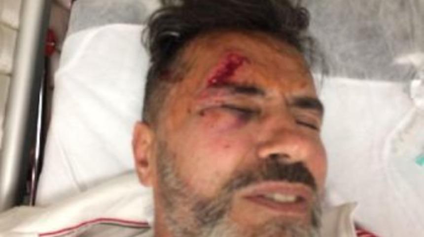 Yaşar Alptekin Ge&ccedil;irdiği Trafik Kazası Sonrası Paylaştığı Fotoğrafla Iyi Olduğunu Yazdı&nbsp;