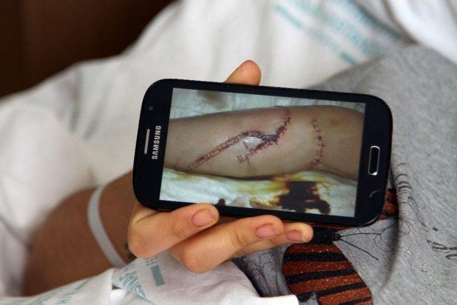 Cezaevinden Firar Etti, Eşine D&ouml;ner Bı&ccedil;ağıyla Saldırdı 1