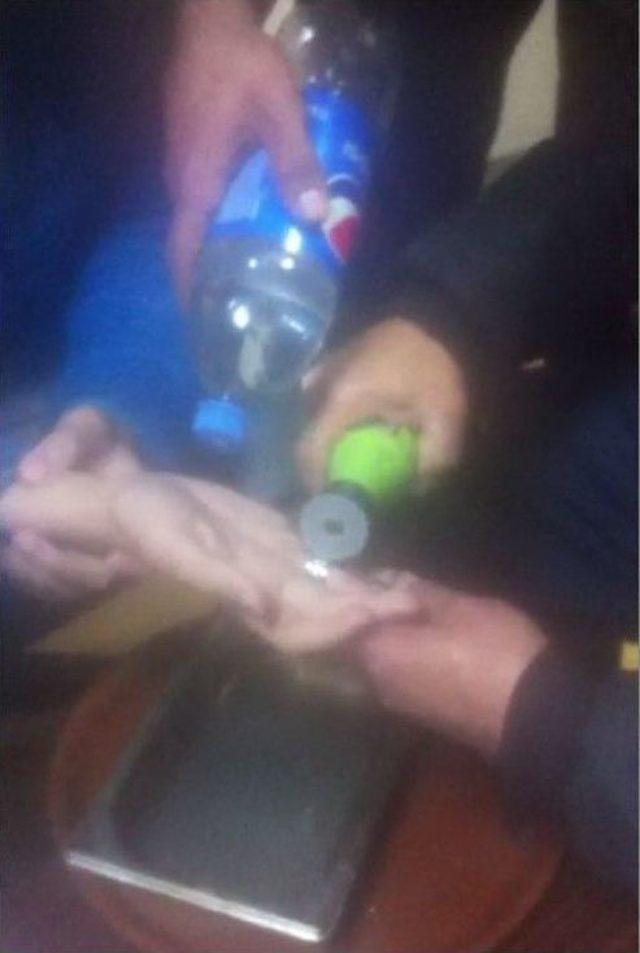 Gencin Parmağına Sıkışan Y&uuml;z&uuml;ğ&uuml; İtfaiye &Ccedil;ıkarttı 1