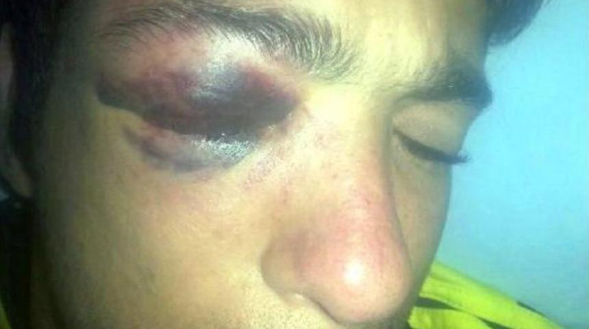 Zihinsel Engelli Genci D&ouml;ven Polise 'saygılı Tutum' Indirimi